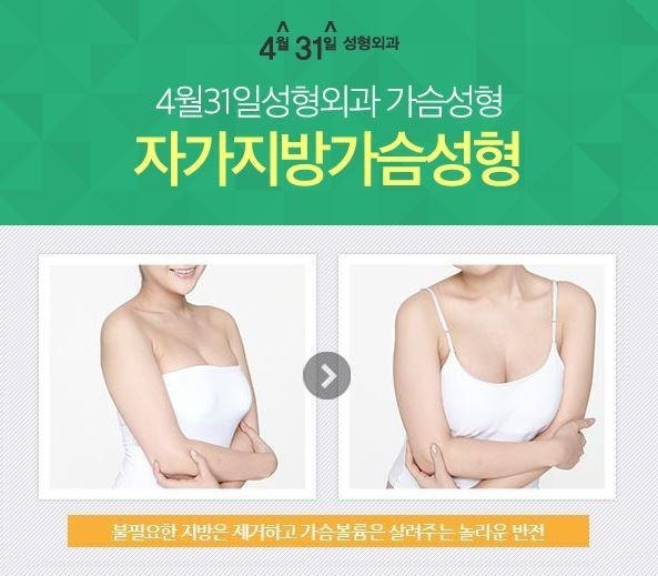 지방이식가슴성형 볼륨가득 4월31일성형외과 관련 이미지 2