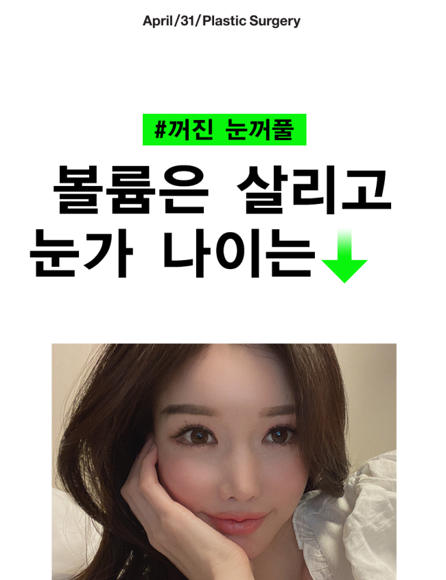 For Sunken Eyelids, Director Oh Won-seok’s Eyelid Volume Up ↑↑↑ image 1