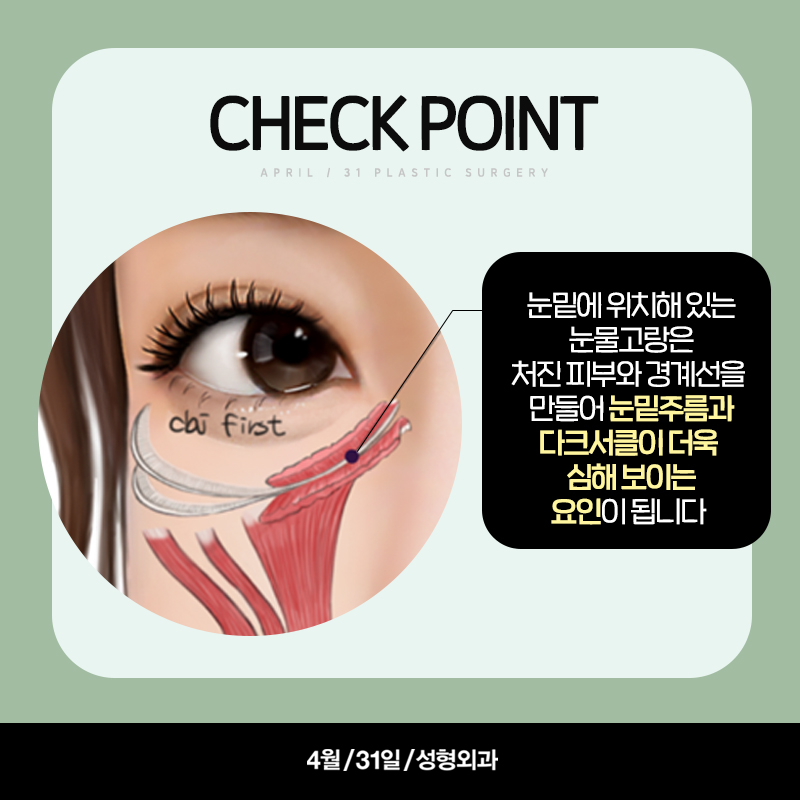 Lower Eyelid Fat Repositioning vs. Lower Eyelid Fat Removal: Which Should You Choose? image 2