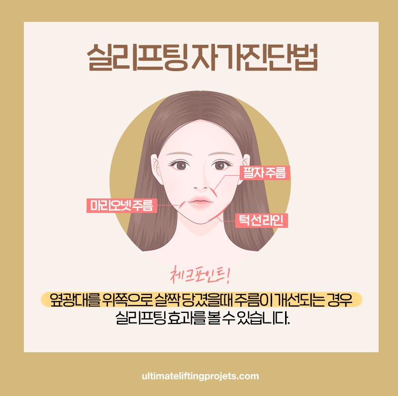 The Effects of Thread Lifting That Make You Look 10 Years Younger and Who It’s Recommended For, a Procedure Many Celebrities Also Do image 7