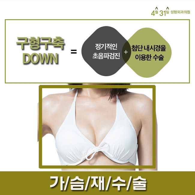 가슴구형구축 정밀한 진단으로 더 만족스럽게 관련 이미지 1