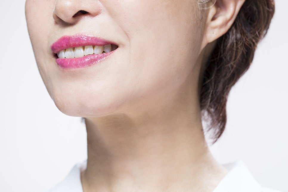 Looking 10 Years Younger with Nasolabial Fold Treatments (Botox/Filler/Thread Lifting) image 2