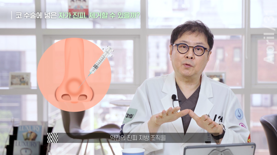 [코성형] 코에 넣은 자가진피, 마음에 안든다면? 관련 이미지 6