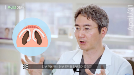 뭉툭한 코, 매부리코를 가지고 있다면 관련 이미지 4