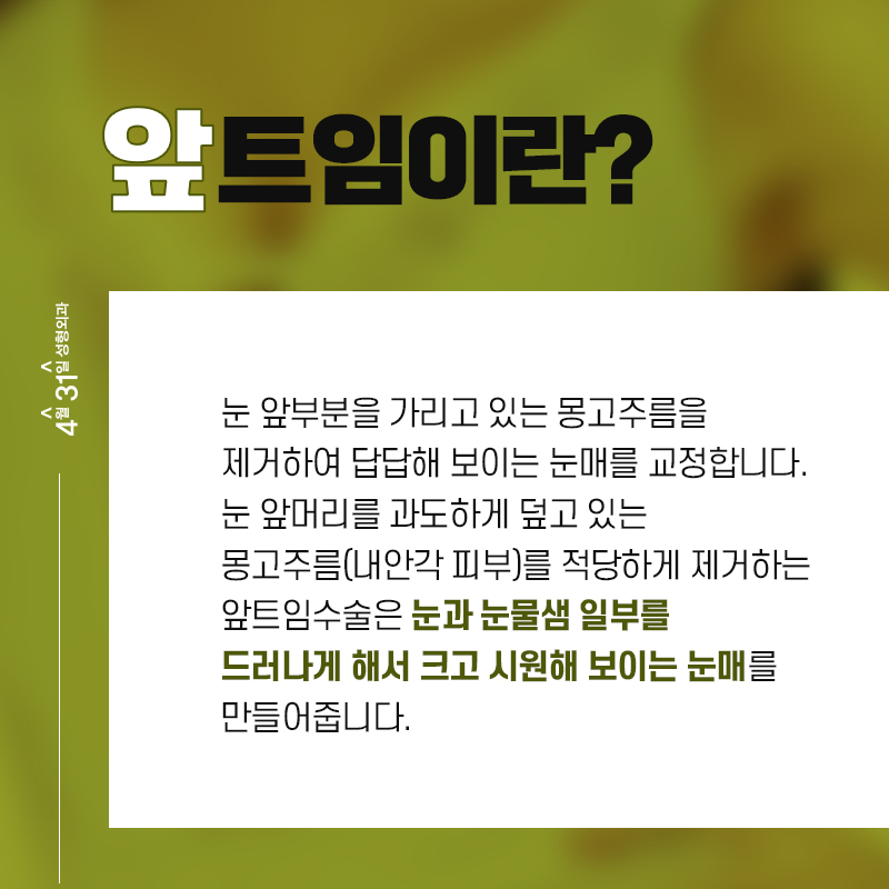 앞트임성형 답답함을 없애요 관련 이미지 2