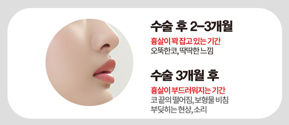 [코성형] 코수술 후 냄새나고, 딱딱 소리가 난다? 관련 이미지 3