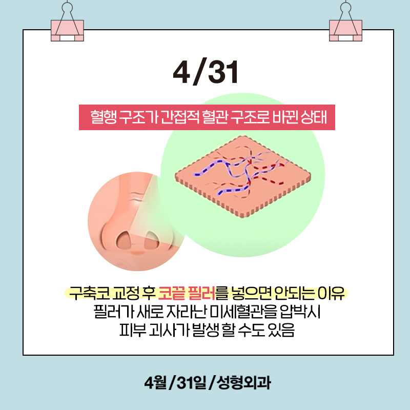 [Contracted Nose] Deep Analysis of the 5-Step Contracted Nose Correction Surgery Part 01_ Sufficient Dissection and Release image 9