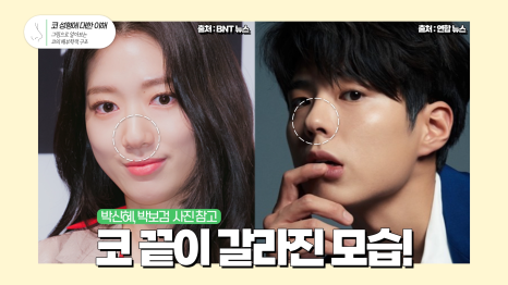 4/31 코성형 - 코의 단면 구조 집중정리! 관련 이미지 7