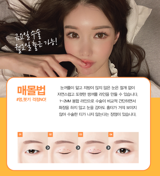 쌍꺼풀잘하는병원 학동역 4월31일성형외과 관련 이미지 2