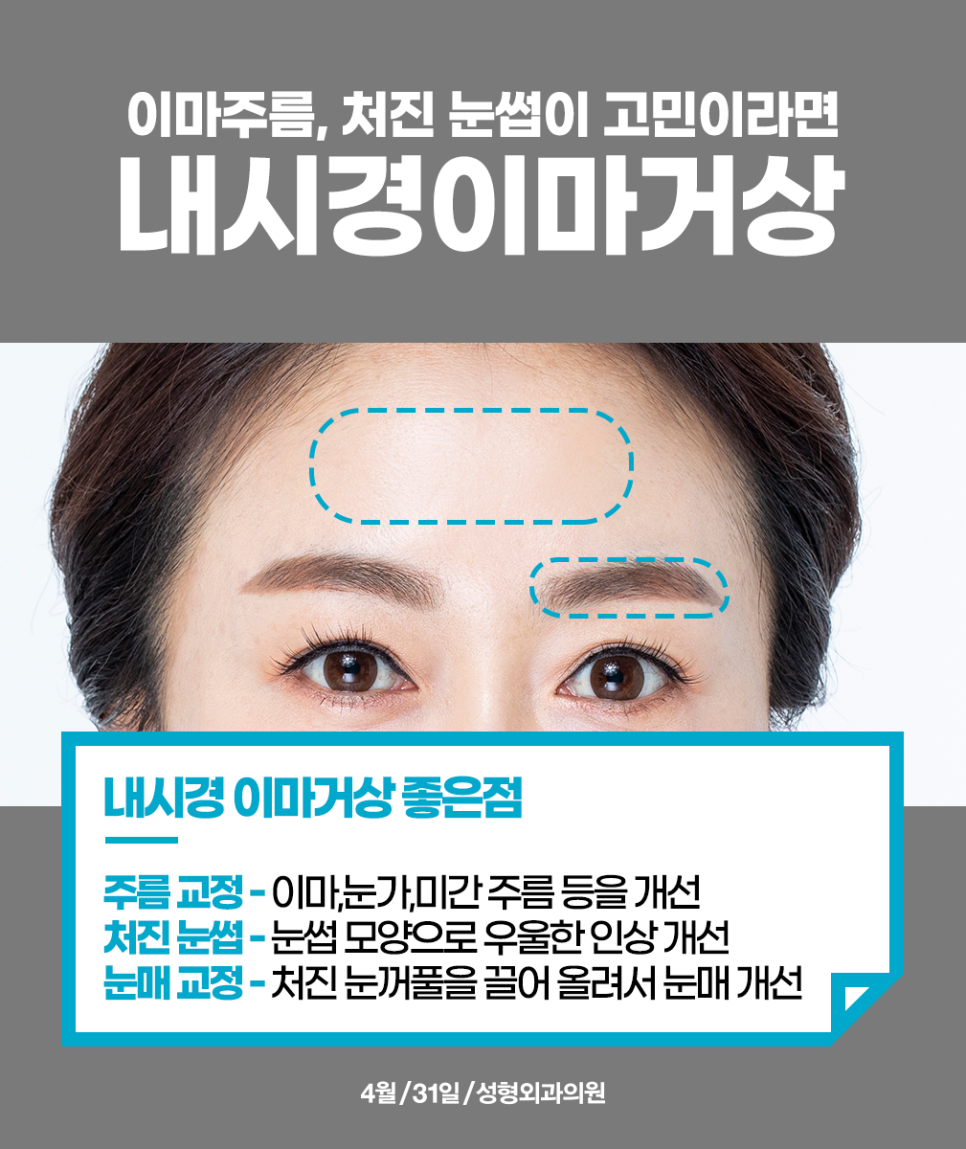 A Hospital That’s Good at Forehead Lift Surgery: Forehead Wrinkles and Drooping Eyebrows, No More Worries image 2