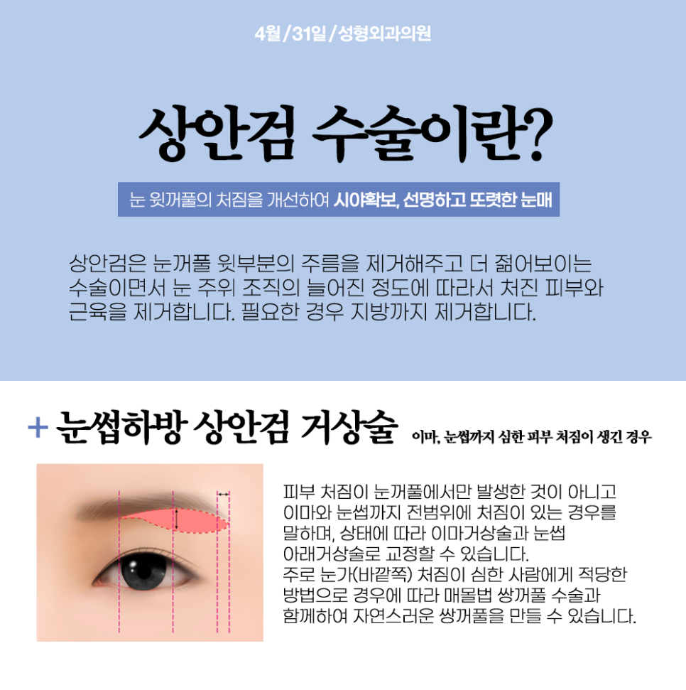 Regain a Younger Look with Middle-Age Eye Surgery Near Sinsa Station image 3