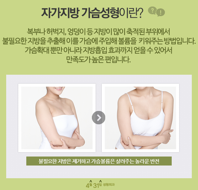 지방이식가슴수술 볼륨을 주는 4월31일성형외과 관련 이미지 1