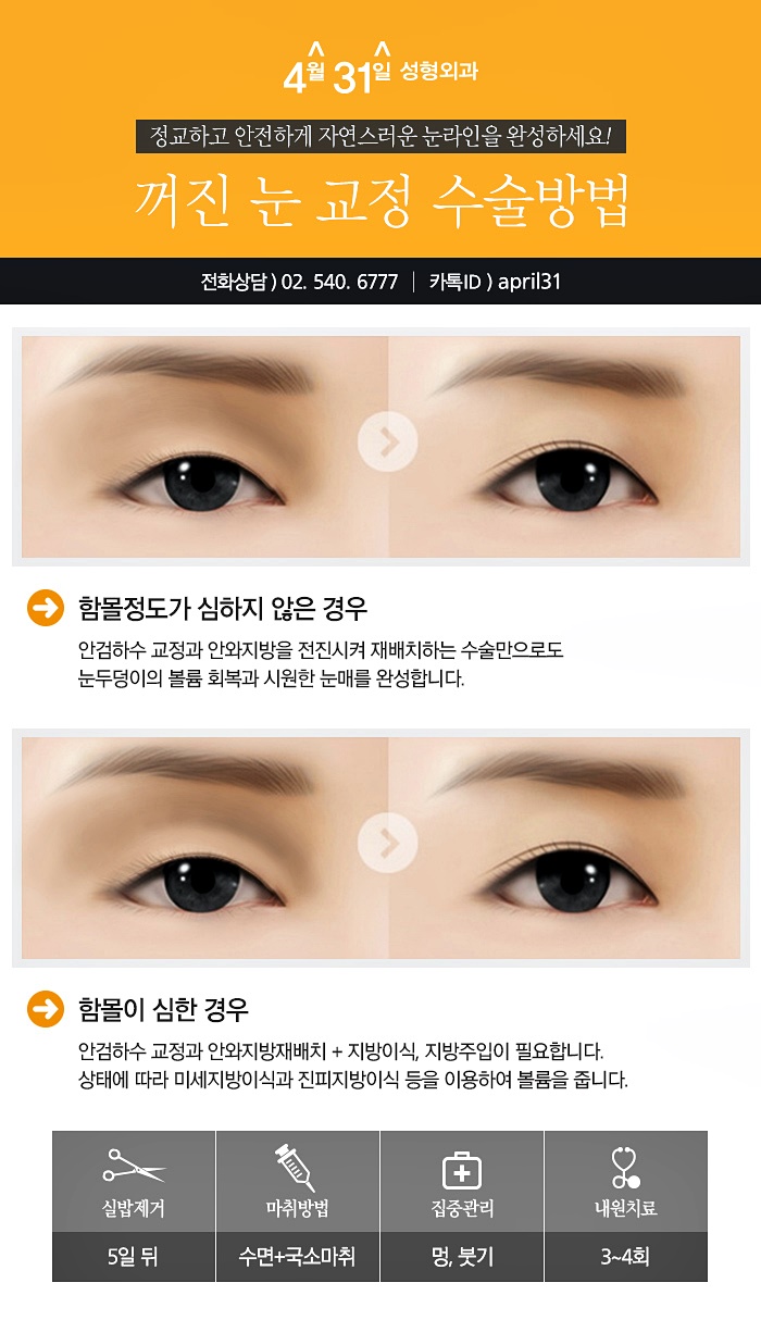 눈꺼풀볼륨업 4월31일성형외과에서 개선하자! 관련 이미지 5
