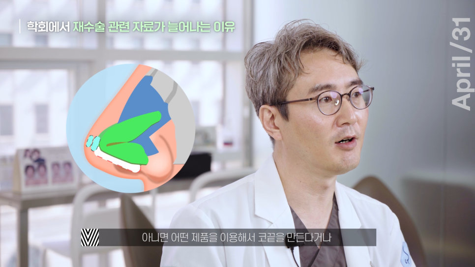 [Revision Rhinoplasty] What Is the Golden Time for Revision Rhinoplasty? image 7