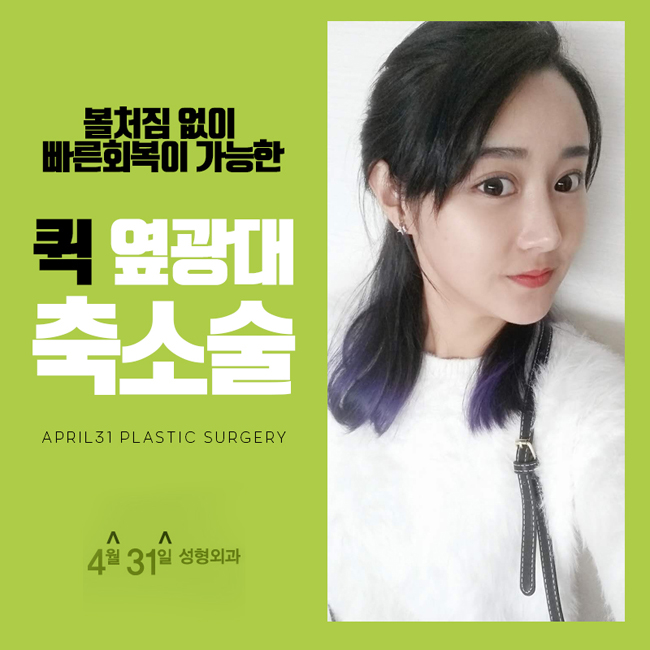 옆광대수술 4월31일성형외과 관련 이미지 1