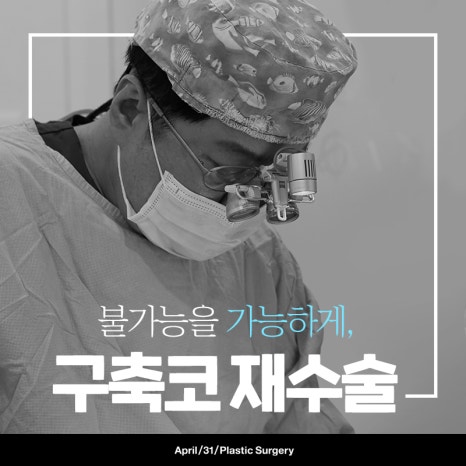 [Contracted Nose] Deep Analysis of the 5-Step Contracted Nose Correction Surgery Part 01_ Sufficient Dissection and Release image 2