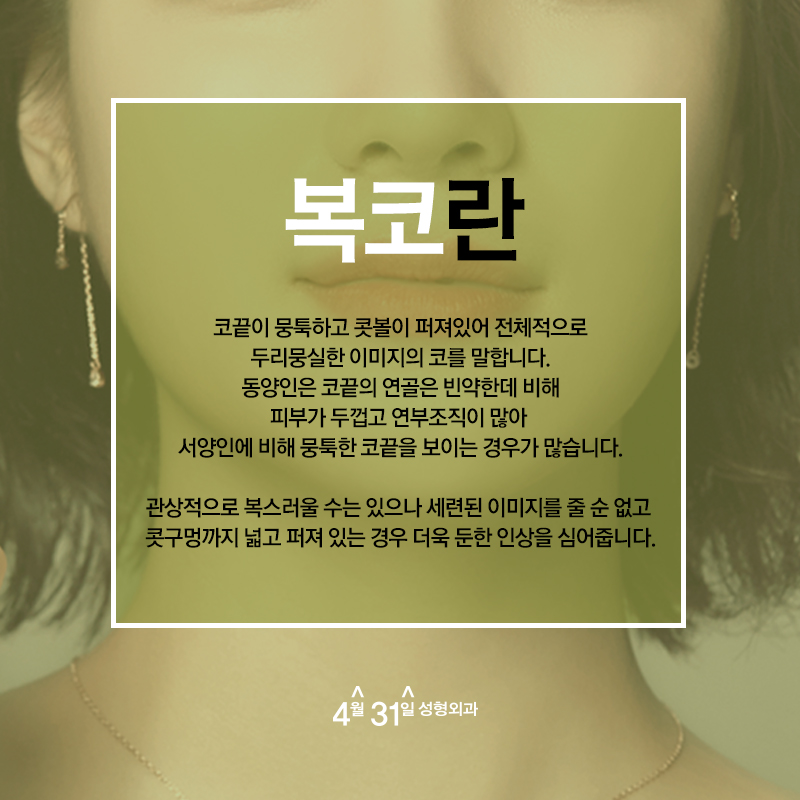 복코성형잘하는병원 4월31일성형외과 알아보자 관련 이미지 2