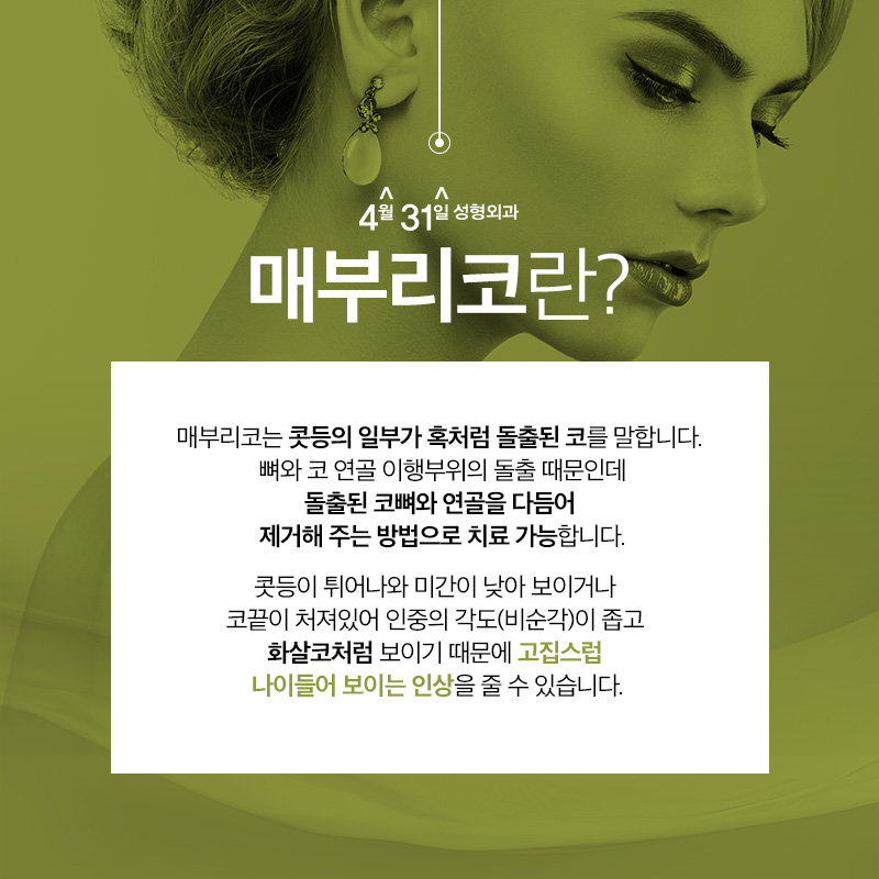 강남매부리코수술 4월31일성형외과에서 매끈하게 관련 이미지 2