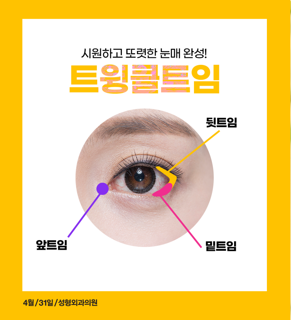 Back Canthoplasty and Lower Canthoplasty Price: If You Want a Bright, Open Eye Shape, Try Twinkle Canthoplasty! image 2