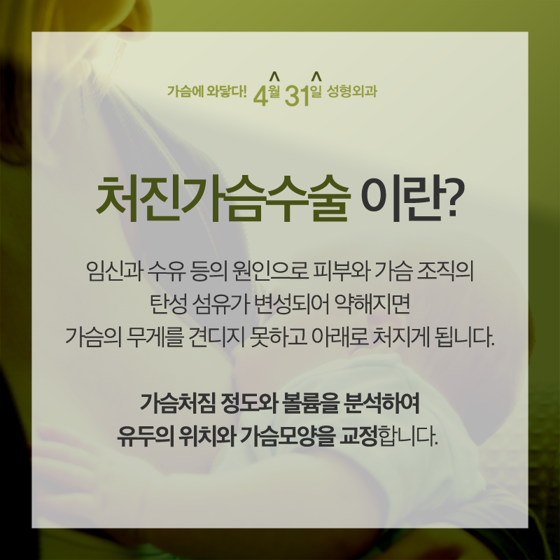 강남역처진가슴교정 자존감까지 올리고 싶다면 관련 이미지 2