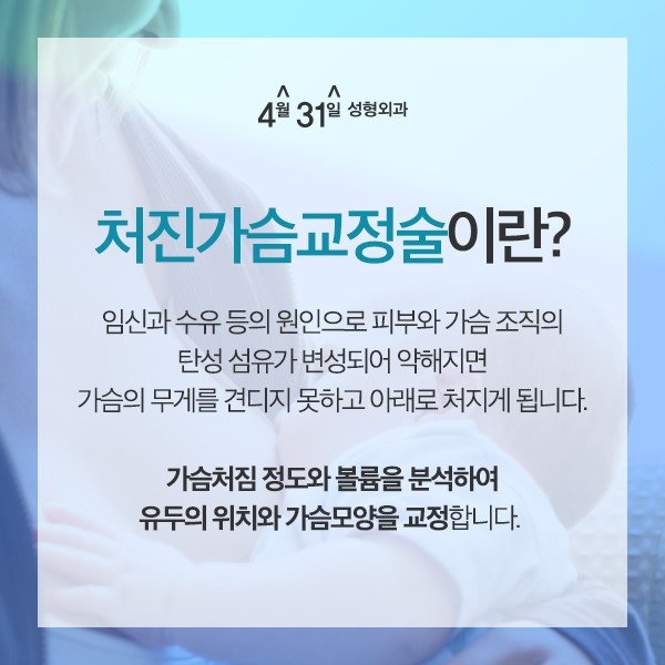유방하수교정 4월31일성형외과 관련 이미지 2