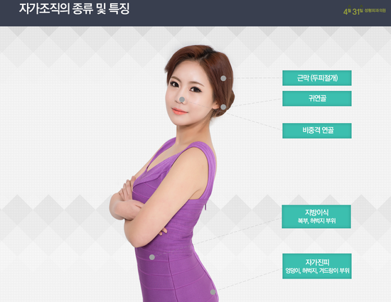 자가조직코성형 4월31일성형외과의원에서 자연스럽게! 관련 이미지 2