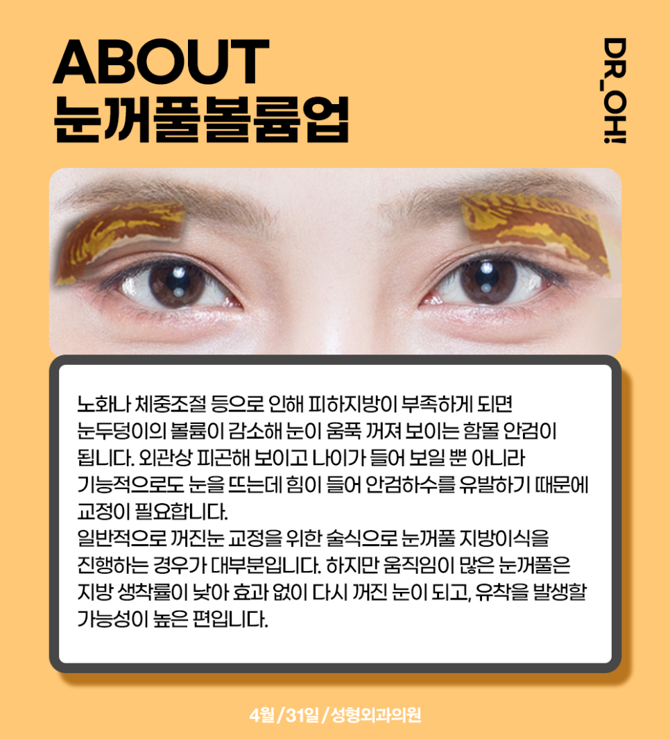 Fill in Hollow Eyelids with Eyelid Volume-Up and Create a More Youthful Eye Look image 3