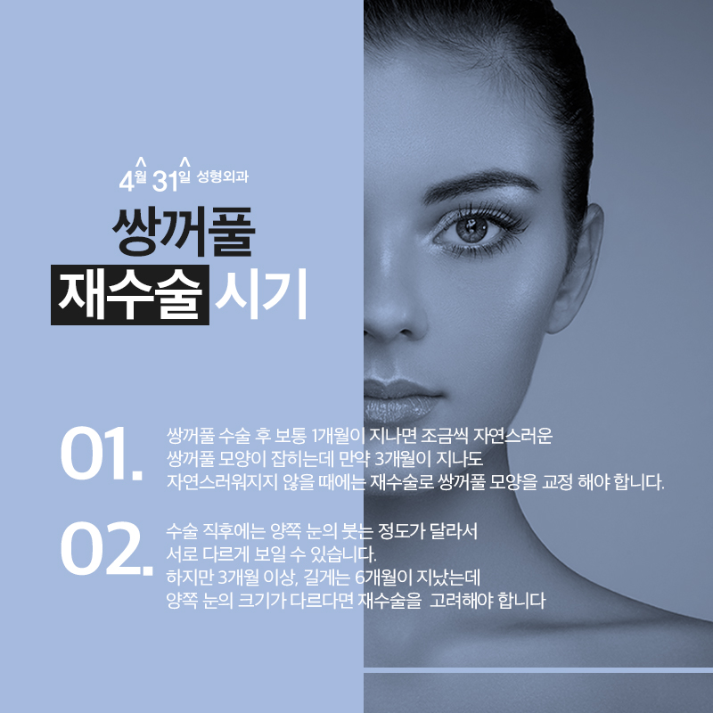 쌍꺼풀재수술후기 4월31일성형외과의 만족감! 관련 이미지 5