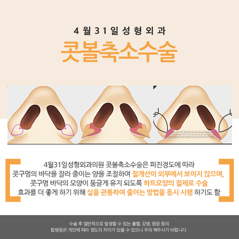 콧볼축소 효과적으로 4월31일성형외과의원에서 관련 이미지 2