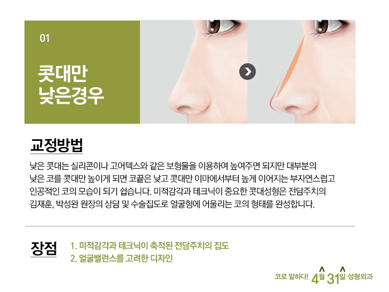 강남코성형잘하는곳 4월31일 성형외과 [첫코수술] 관련 이미지 4