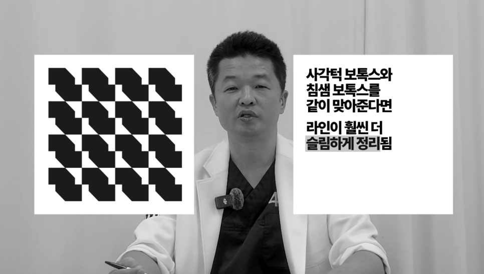 [Ultimate Lifting Proje] Top 3 Petit Procedures That Are Good to Do During the Lunar New Year Holiday image 5