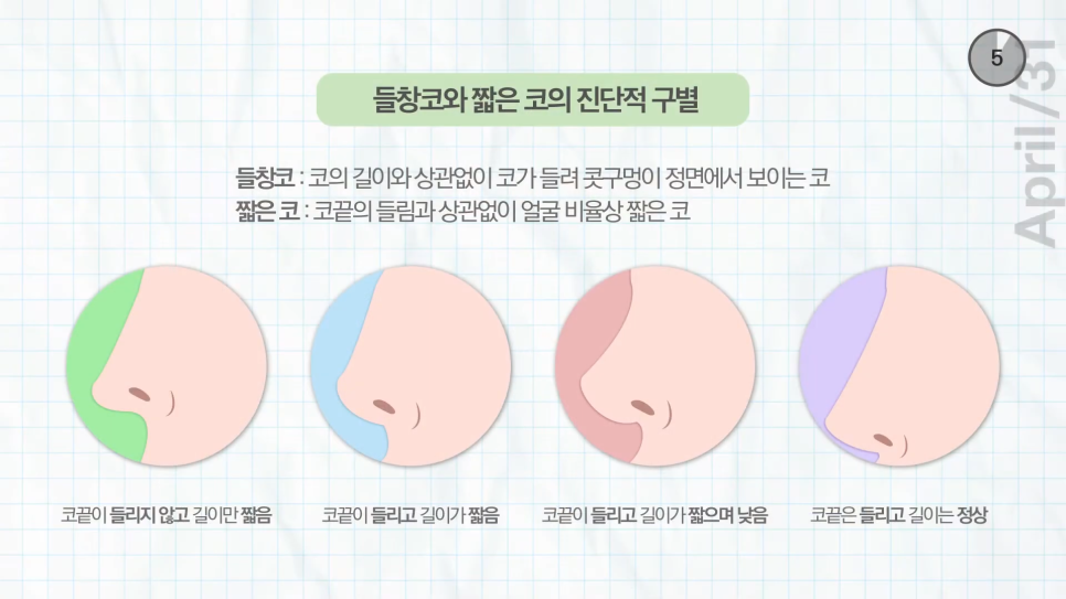 [코성형] 짧은코?들창코? 상태에 따른 수술방법 전격공개! 관련 이미지 6