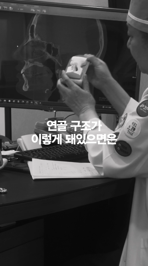 [April 31 Plastic Surgery] I can see the silicone at the tip of my nose... Is that okay? image 4