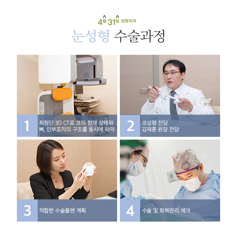 쌍꺼풀재수술후기 4월31일성형외과의 만족감! 관련 이미지 6