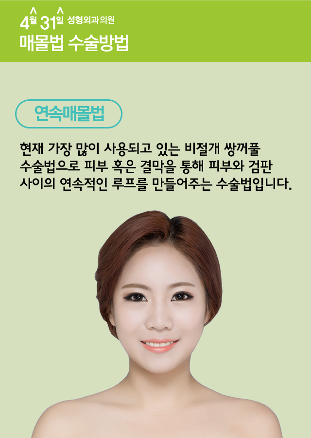 매몰법잘하는곳 4월31일성형외과의원 관련 이미지 2