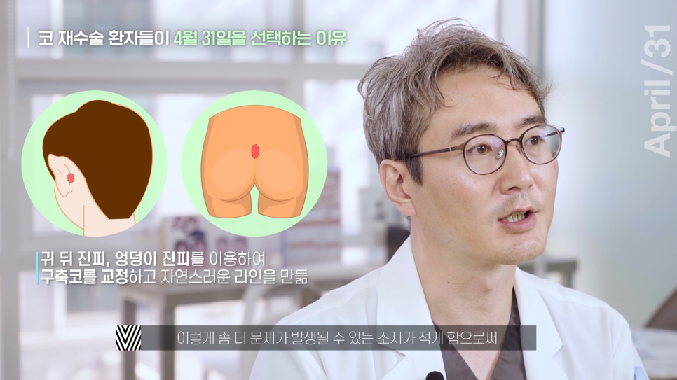 [Revision Rhinoplasty] What Is the Golden Time for Revision Rhinoplasty? image 5