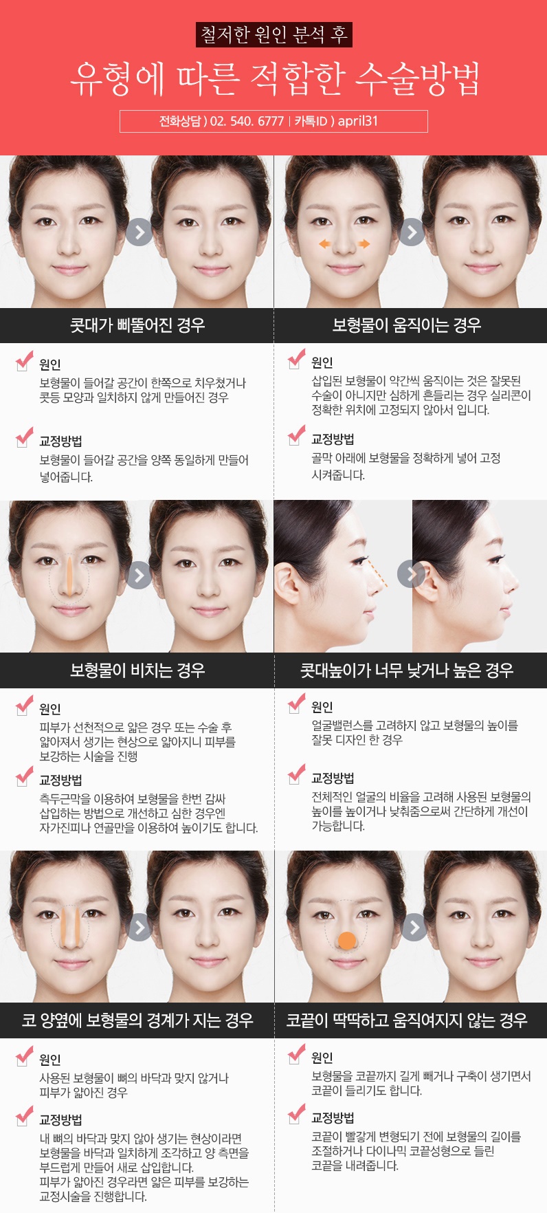 코재수술유명한곳 왜4월31일성형외과의원일까 관련 이미지 2