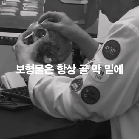 [April 31 Plastic Surgery] The silicone moved after nose surgery! Is that okay? image 3