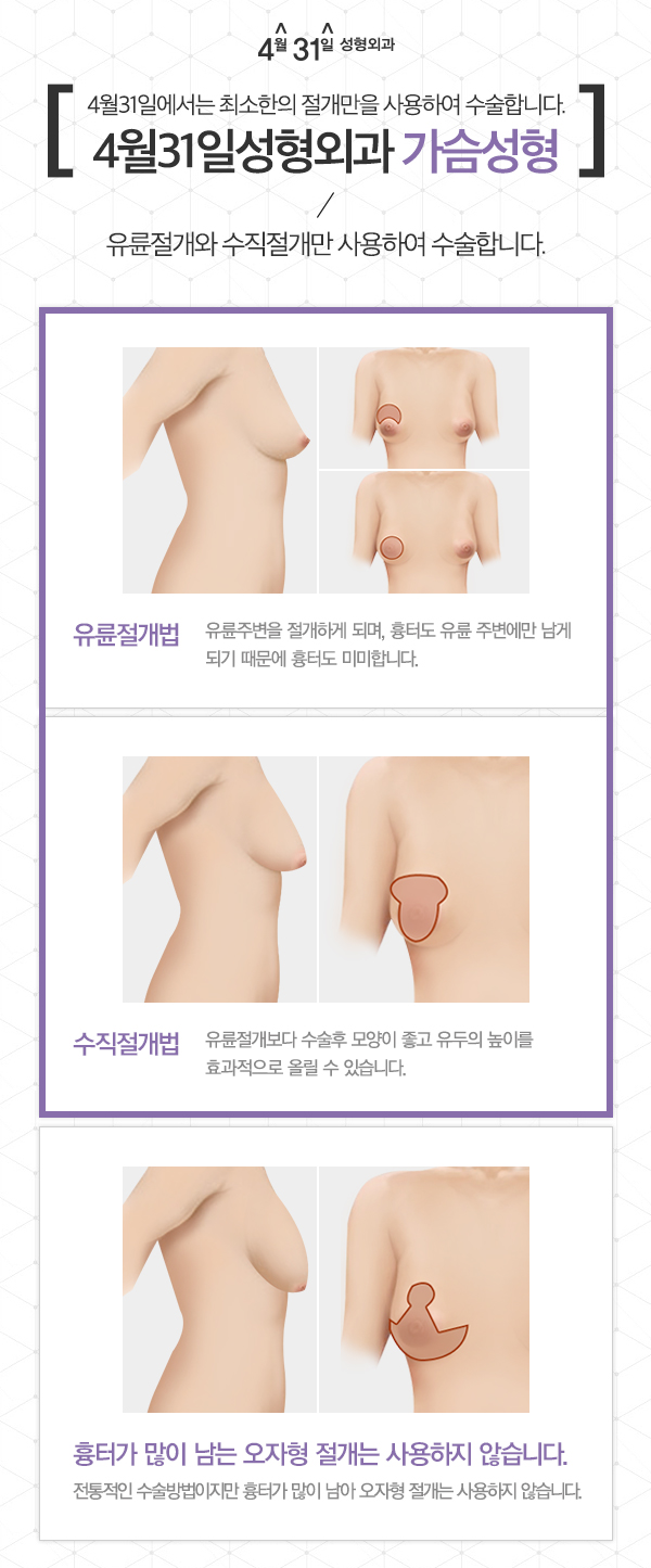 처진가슴수술후기 궁금하다면 4월31일성형외과에서 관련 이미지 3