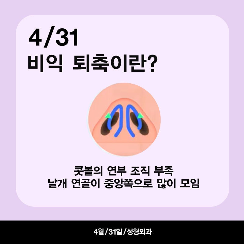 [코성형] 용코?비익퇴축술 파헤치기! 관련 이미지 2
