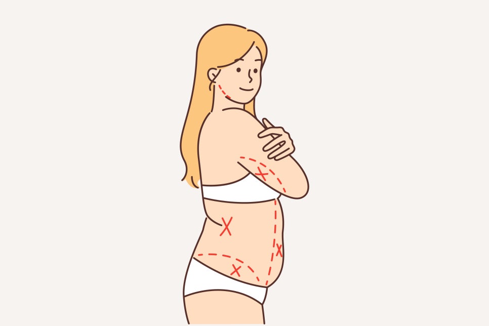 Achieve Dieting Success Easily and Safely with Fat-Dissolving Injections! image 9