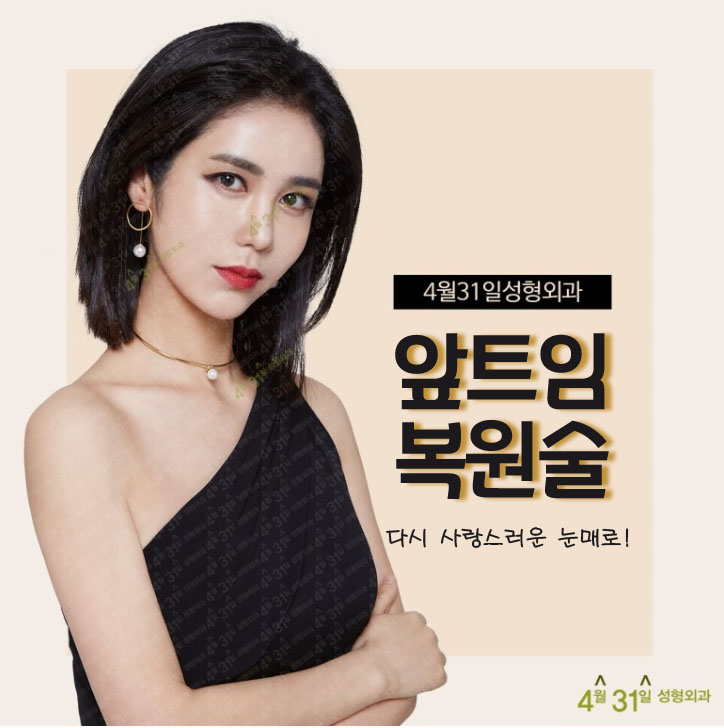 앞트임복원후기 좋은 곳 4월31일성형외과 관련 이미지 1