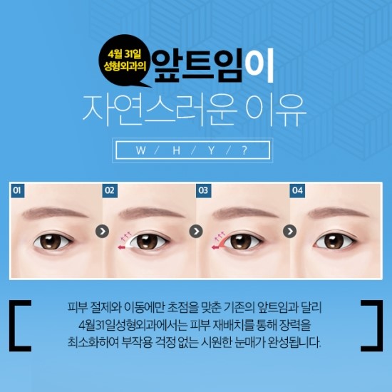 앞트임잘하는병원 4월31일성형외과의원 어때요? 관련 이미지 2