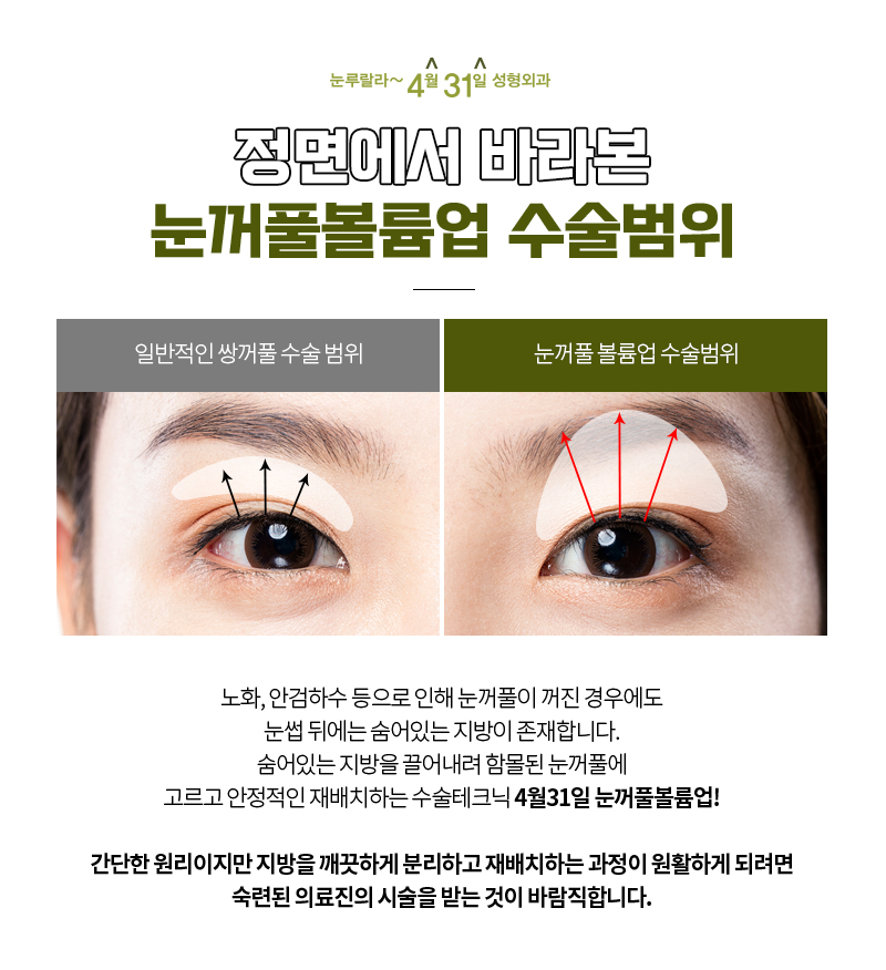 눈꺼풀지방이식보다 더 효과적으로 볼륨을 개선하는 방법은? 관련 이미지 3