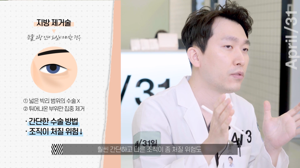Lower Eyelid Fat Repositioning vs. Lower Eyelid Fat Removal: Which Should You Choose? image 4