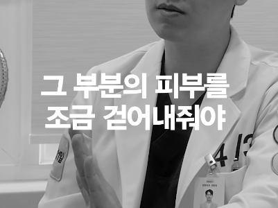 [April 31 Plastic Surgery] How Should a Burial-Method Double Eyelid Revision Be Done? image 8