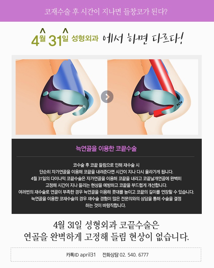 코재수술유명한곳 왜4월31일성형외과의원일까 관련 이미지 1