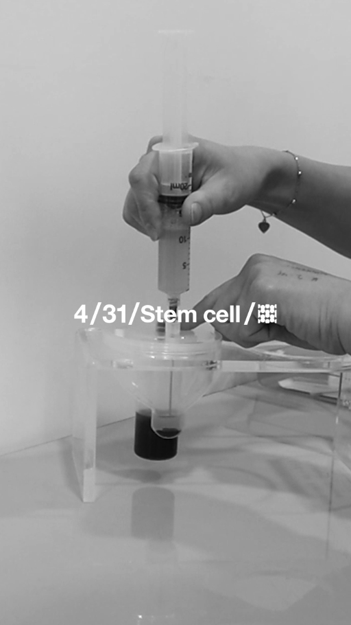 [April 31 Plastic Surgery] 4/31 Stem Cell Injection image 1