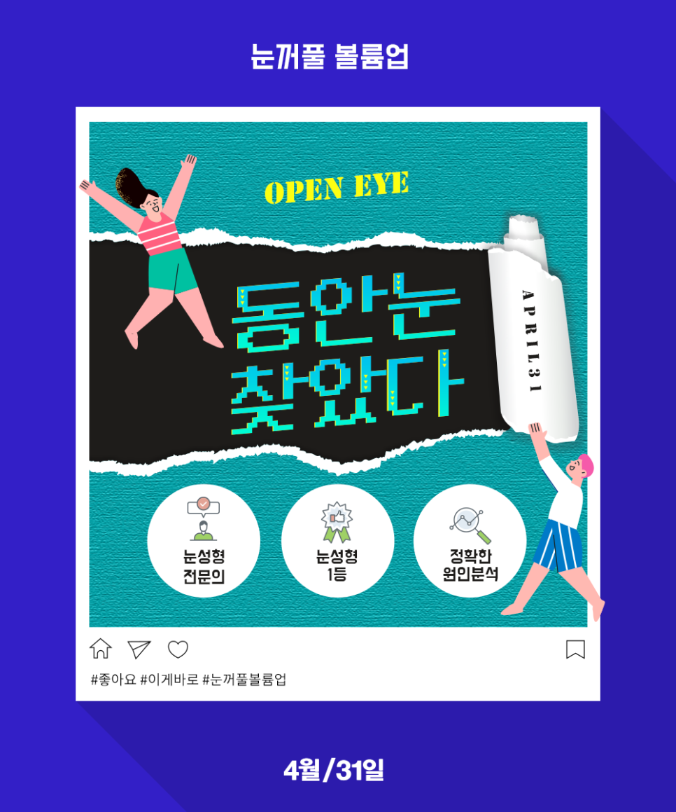 꺼진눈성형비용 시원하고 동안눈매를 원한다면 관련 이미지 1