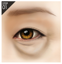 [De-Aging] Improve Under-Eye Sagging and Create a Youthful Eye Area with Aegyosal - Soup Lift image 3